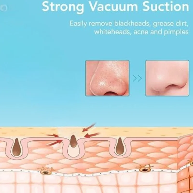 FPLS-001 facial pore cleansing vacuum for blackhead removal